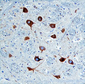 Nogo-C Antibody in Immunohistochemistry (Paraffin) (IHC (P))