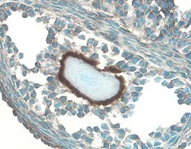 IGFBP5 Antibody in Immunohistochemistry (Frozen) (IHC (F))