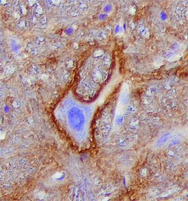 Neurocan Antibody in Immunohistochemistry (Frozen) (IHC (F))