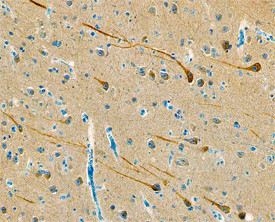 SULT4A1 Antibody in Immunohistochemistry (Paraffin) (IHC (P))