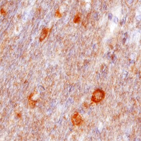 VAPB Antibody in Immunohistochemistry (Paraffin) (IHC (P))