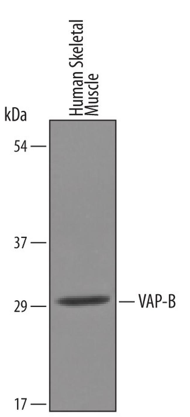 VAPB Antibody in Western Blot (WB)