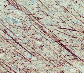 FABP8 Antibody in Immunohistochemistry (Paraffin) (IHC (P))