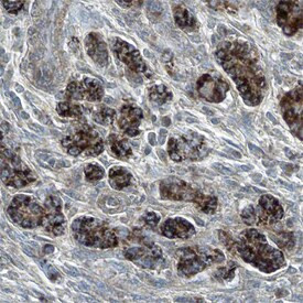 SEMA5A Antibody in Immunohistochemistry (Paraffin) (IHC (P))