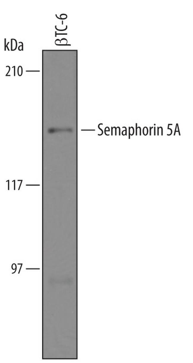 SEMA5A Antibody in Western Blot (WB)