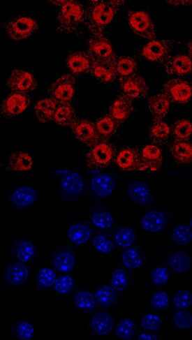 ADNP Antibody in Immunocytochemistry (ICC/IF)