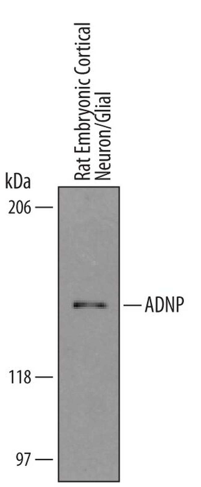 ADNP Antibody in Western Blot (WB)