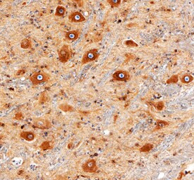 LRP4 Antibody in Immunohistochemistry (Paraffin) (IHC (P))