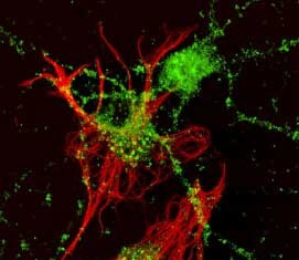 Ephrin A2 Antibody in Immunocytochemistry (ICC/IF)