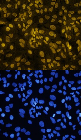 TWIST1 Antibody in Immunocytochemistry (ICC/IF)