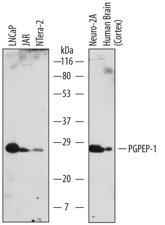 PGPEP1 Antibody in Western Blot (WB)