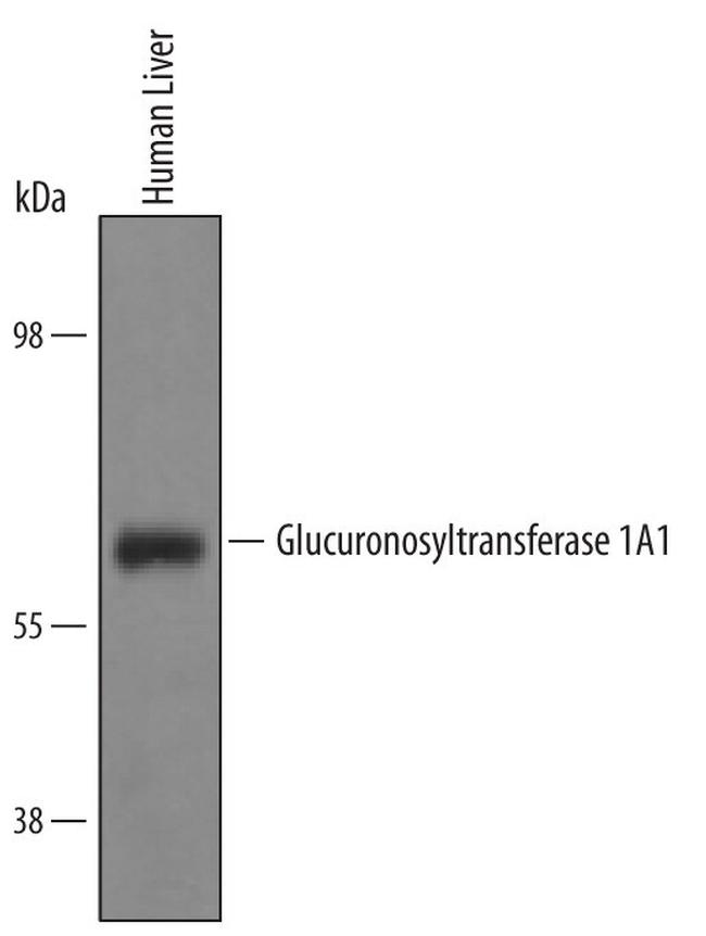 UGT1A1 Antibody in Western Blot (WB)