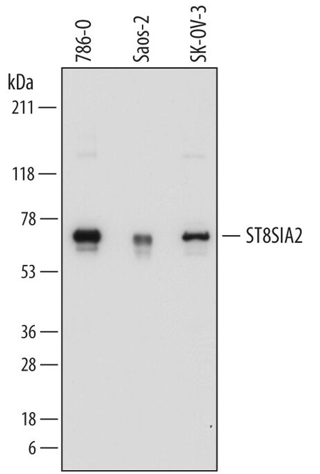 ST8SIA2 Antibody in Western Blot (WB)