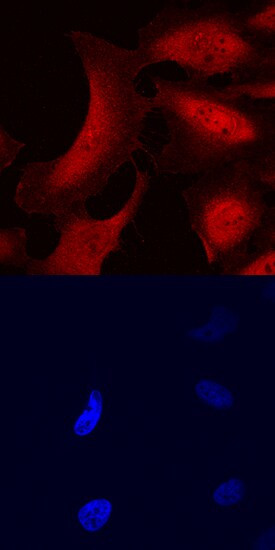 STS1 Antibody in Immunocytochemistry (ICC/IF)