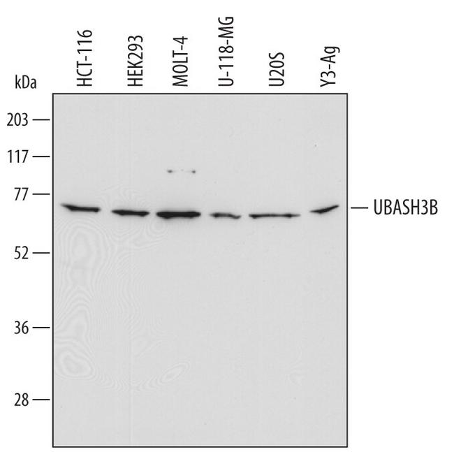 STS1 Antibody in Western Blot (WB)