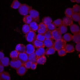 PCDH15 Antibody in Immunocytochemistry (ICC/IF)