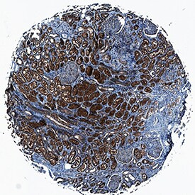 PCDH15 Antibody in Immunohistochemistry (Paraffin) (IHC (P))