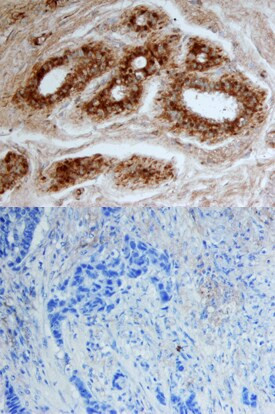 CELSR2 Antibody in Immunohistochemistry (Paraffin) (IHC (P))