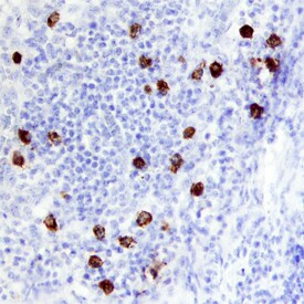 TCL1B Antibody in Immunohistochemistry (Paraffin) (IHC (P))