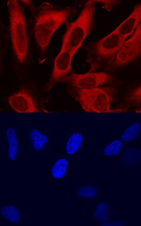 TMSB4X Antibody in Immunocytochemistry (ICC/IF)