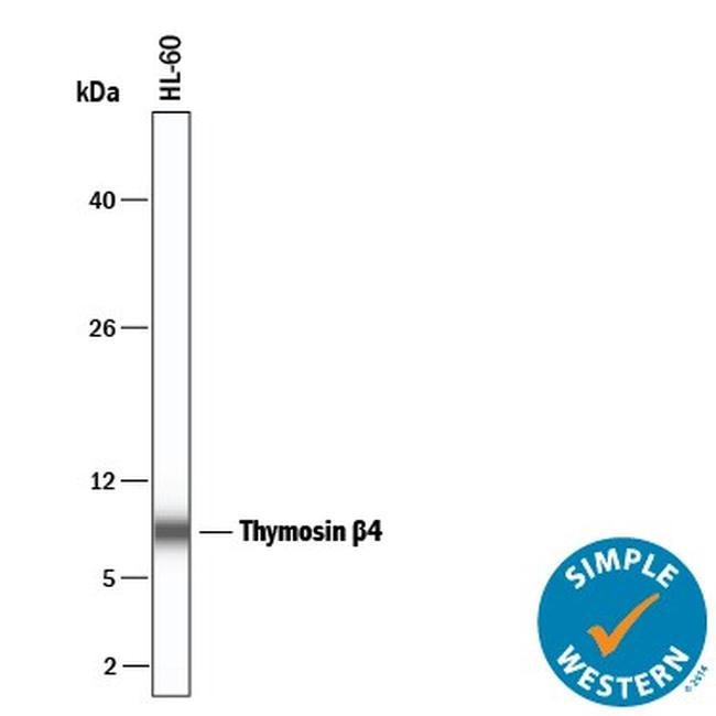 TMSB4X Antibody in Western Blot (WB)