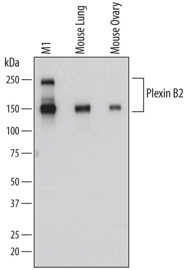 PLXNB2 Antibody in Western Blot (WB)