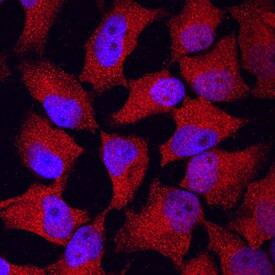 Folate Receptor alpha Antibody in Immunocytochemistry (ICC/IF)