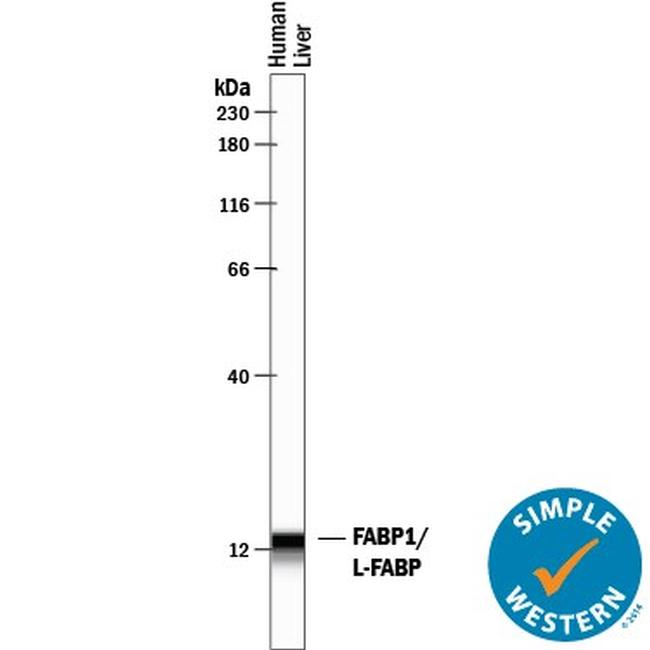 FABP1 Antibody in Western Blot (WB)