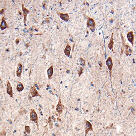 AgRP Antibody in Immunohistochemistry (Paraffin) (IHC (P))