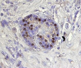 ARX Antibody in Immunohistochemistry (Paraffin) (IHC (P))