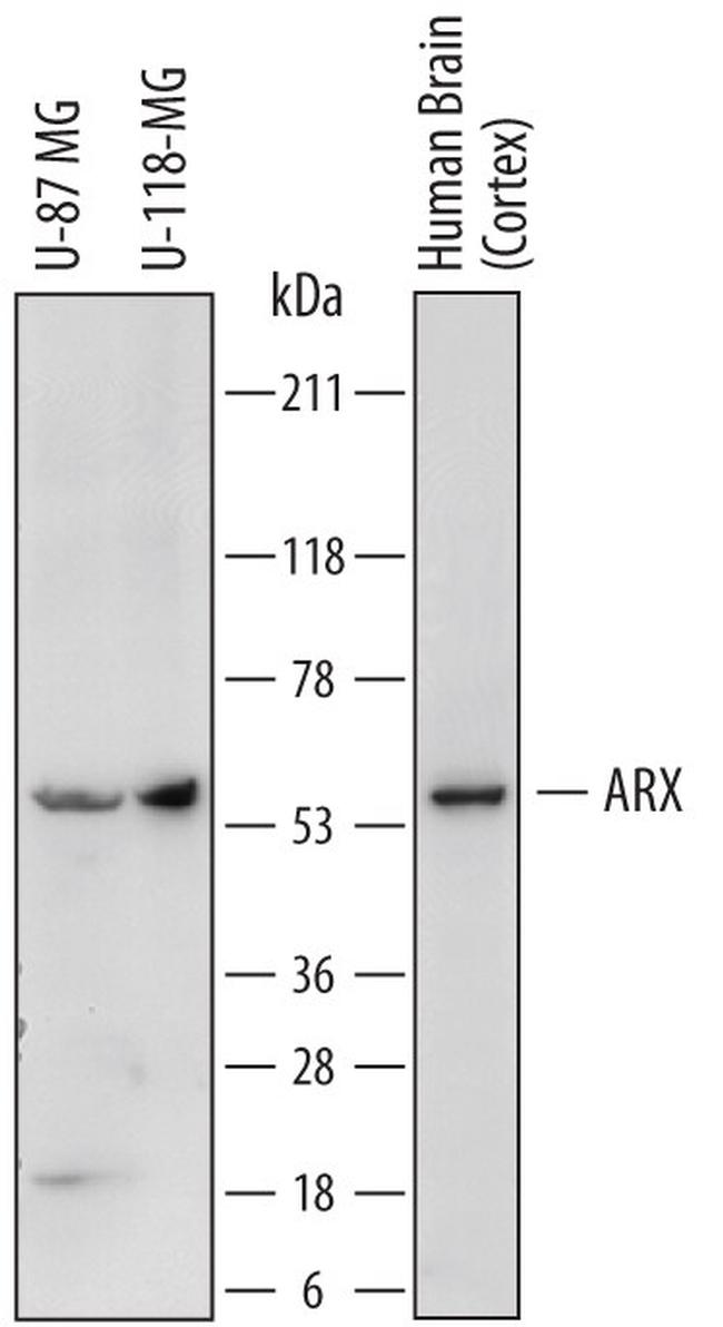 ARX Antibody in Western Blot (WB)