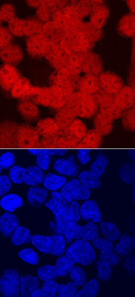 CRX Antibody in Immunocytochemistry (ICC/IF)