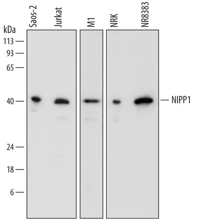 PPP1R8 Antibody in Western Blot (WB)