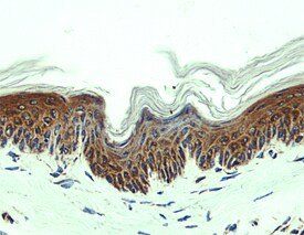 CCL27 Antibody in Immunohistochemistry (Frozen) (IHC (F))