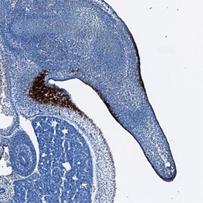 Desmocollin 3 Antibody in Immunohistochemistry (Frozen) (IHC (F))