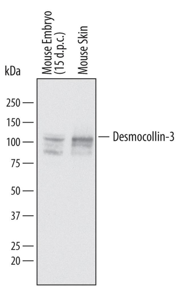 Desmocollin 3 Antibody in Western Blot (WB)