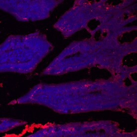 SLC39A4 Antibody in Immunohistochemistry (Frozen) (IHC (F))