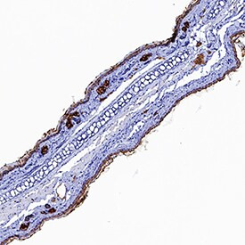 IL1R1 Antibody in Immunohistochemistry (Frozen) (IHC (F))