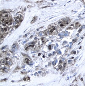 XIAP Antibody in Immunohistochemistry (Paraffin) (IHC (P))