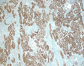 ACE Antibody in Immunohistochemistry (Paraffin) (IHC (P))