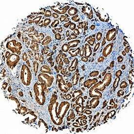 ADAM15 Antibody in Immunohistochemistry (Paraffin) (IHC (P))