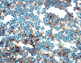 Cathepsin B Antibody in Immunohistochemistry (Frozen) (IHC (F))