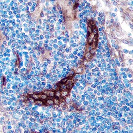 TSLP Receptor Antibody in Immunohistochemistry (Paraffin) (IHC (P))