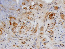 BMP-3 Antibody in Immunohistochemistry (Paraffin) (IHC (P))