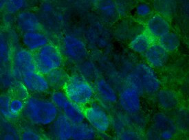 FGF16 Antibody in Immunocytochemistry (ICC/IF)