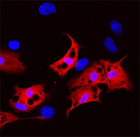 FABP2 Antibody in Immunocytochemistry (ICC/IF)