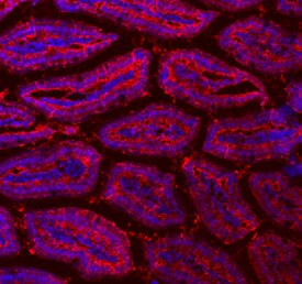 FABP2 Antibody in Immunohistochemistry (Frozen) (IHC (F))