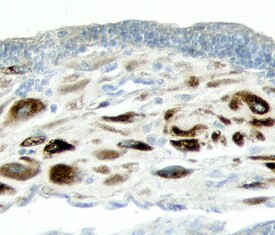 ADAMTS1 Antibody in Immunohistochemistry (Paraffin) (IHC (P))