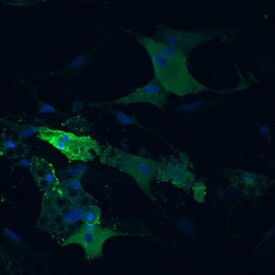 Adiponectin Antibody in Immunocytochemistry (ICC/IF)