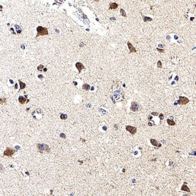 APLP1 Antibody in Immunohistochemistry (Paraffin) (IHC (P))